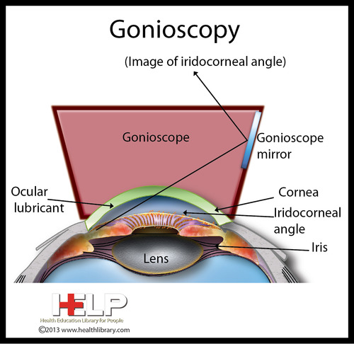 Pt13: Clinical Management Of Glaucoma | Flashcards