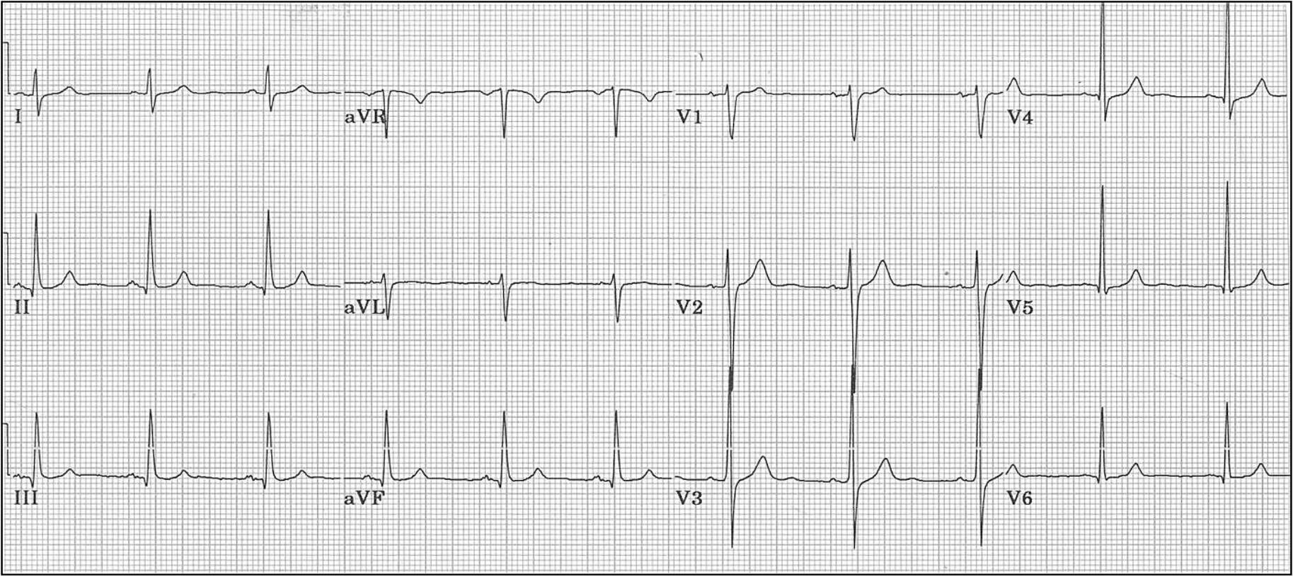 علي عبد الكريم باطنيه كارديو م ١ Flashcards