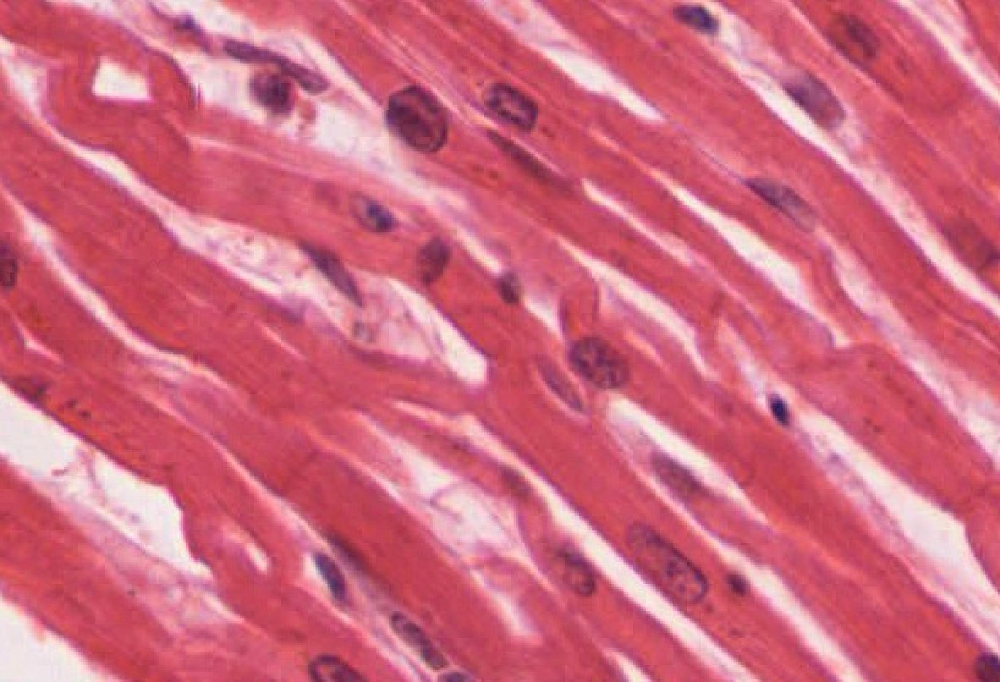 Muscle Tissue Flashcards